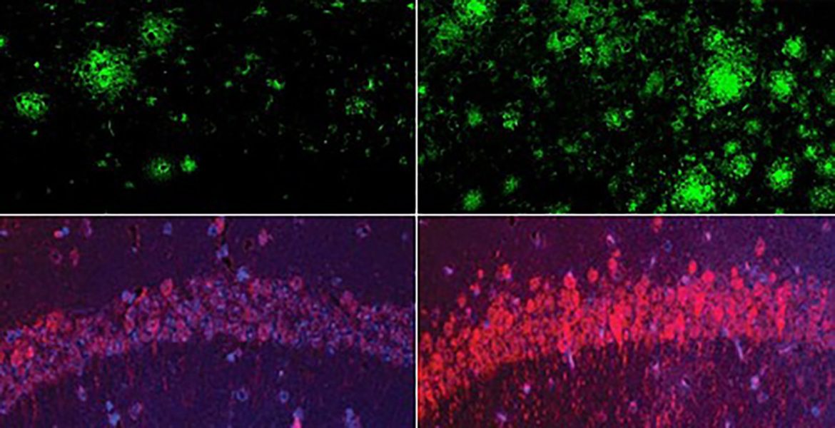 Could lithium explain — and treat — Alzheimer’s?
